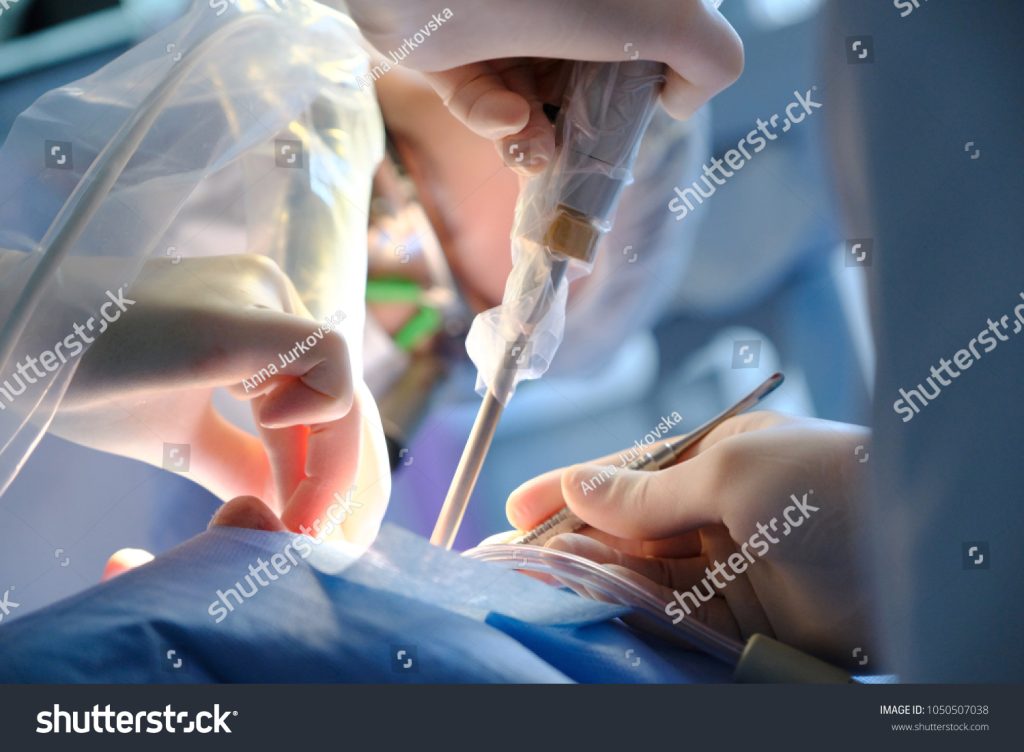 Signs You Might Need Carpal Tunnel Surgery and How It Can Help